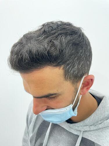 MARTIN MONTOYA - PROFESSIONAL SOCCER PLAYER - PROCEDURE WITH DR BRUNO JACOBOVSKI photo