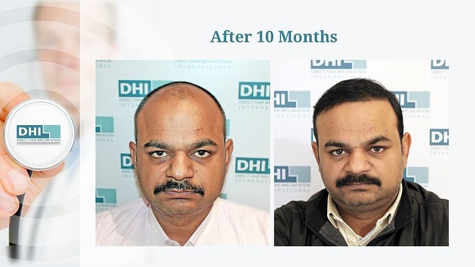 DHI India Result - 1,615 grafts photo