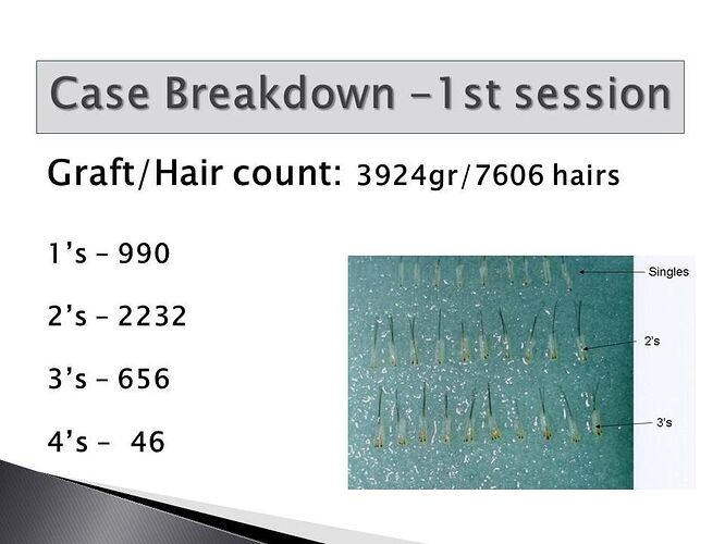Dr. Ron Shapiro – 6177gr/11,939hairs in 2 Strip sessions – NW6 photo