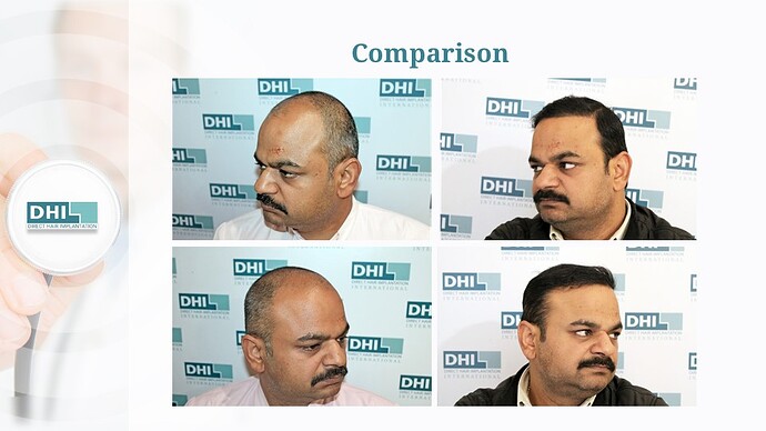 DHI India Result - 1,615 grafts photo