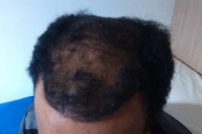 Dr.Bisanga, 1157 Strip Repair, Afro hair, 0 - 7 Months photo