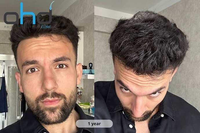 AHD Clinic / Technicians / 4050 grafts / FUE + DHI photo