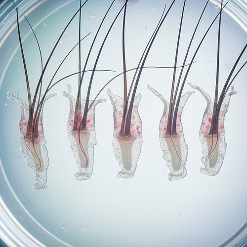 Microscopic view of individual hair grafts