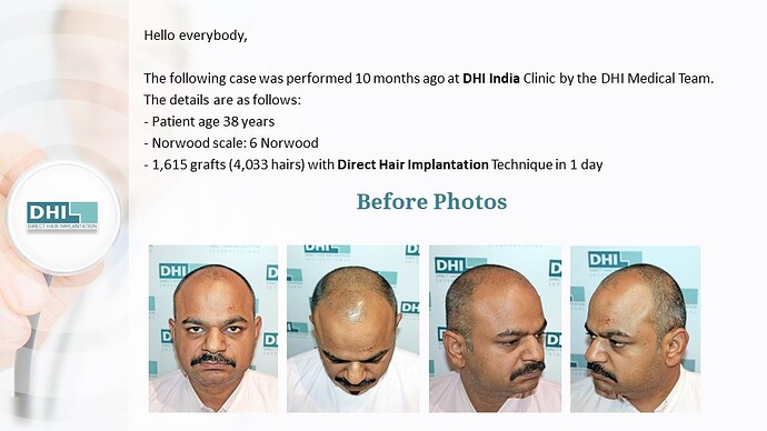 DHI India Result - 1,615 grafts photo