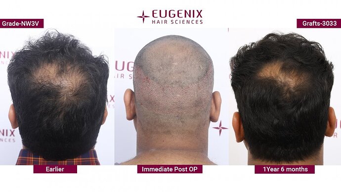 EUGENIX HAIR SCIENCES | NW3V | Unlock confidence with Eugenix photo