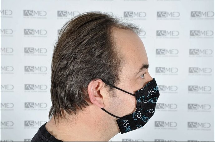 ASMED CLINIC - DR.KORAY - 5060 GRAFTS FUE photo