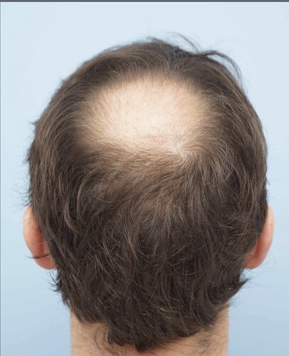 Dr B Farjo 2200g FUT (Crown) photo
