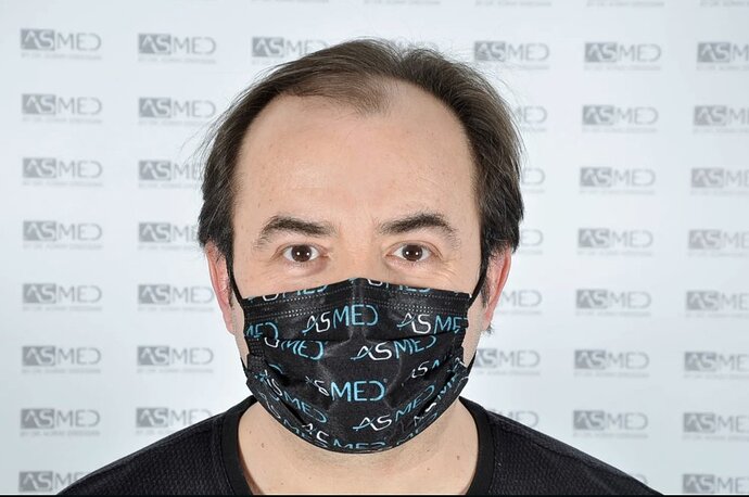 ASMED CLINIC - DR.KORAY - 5060 GRAFTS FUE photo