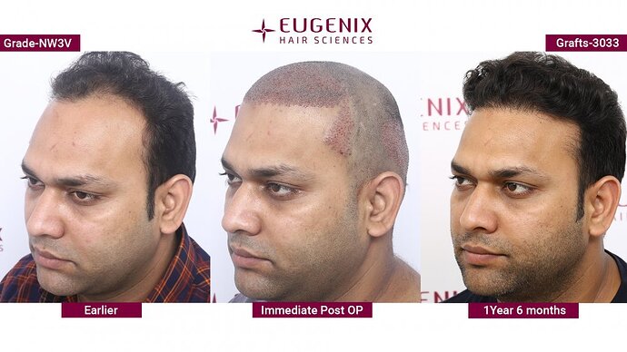 EUGENIX HAIR SCIENCES | NW3V | Unlock confidence with Eugenix photo