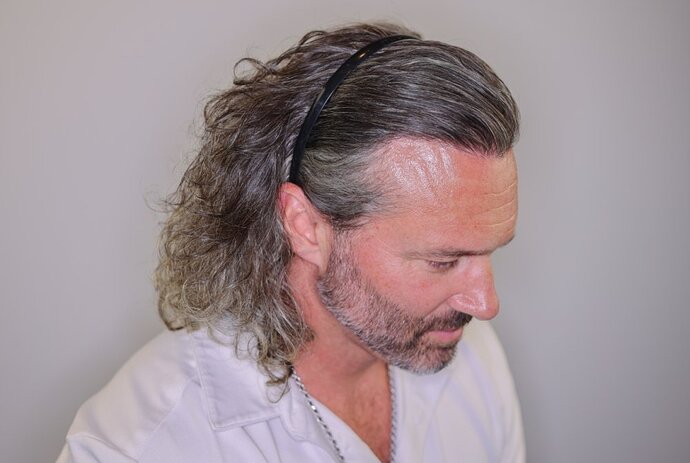 Utah Hair Restoration - Dr. Barton alviarmani photo