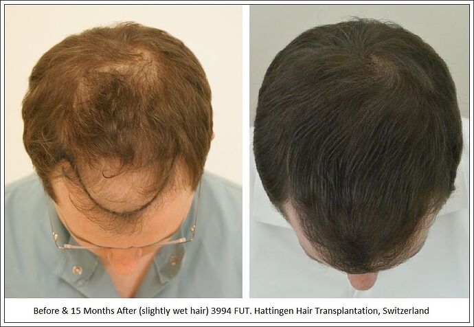 Hattingen Hair. 3994 FUT. 0 - Grown Out photo
