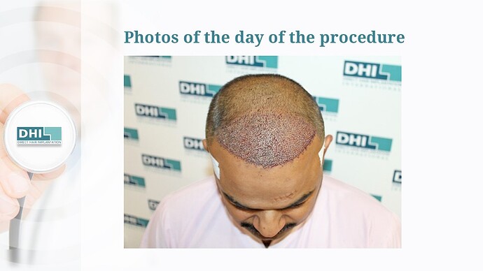 DHI India Result - 1,615 grafts photo