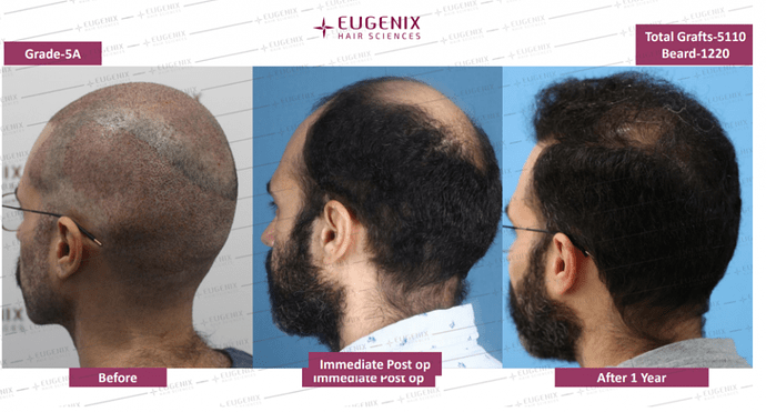 EUGENIX HAIR SCIENCES | FIND YOUR YOUNGER VERSION | DR. ARIKA BANSAL photo