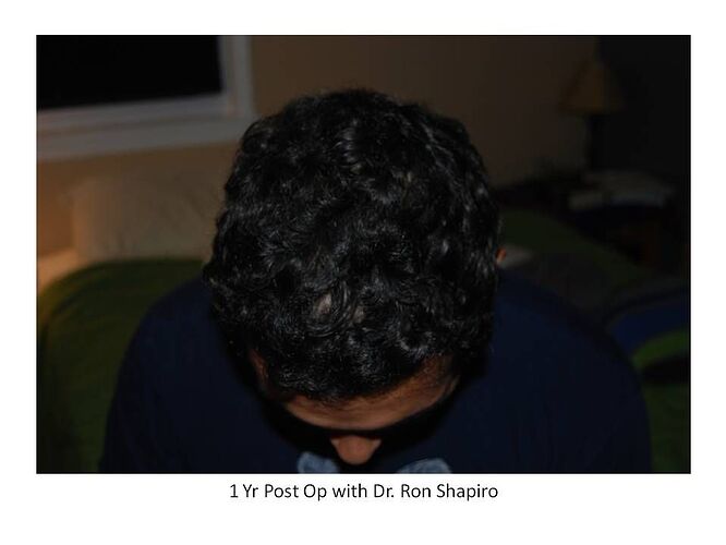 Dr. Ron Shapiro - 2917 Grafts/5557 Hairs photo