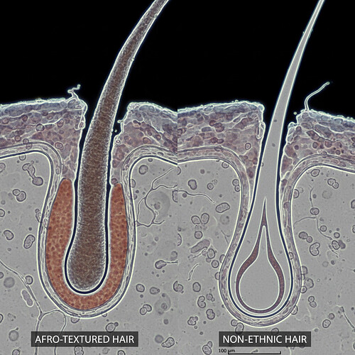 Microscopic comparison of Afro hair follicle root versus standard hair follicle root.