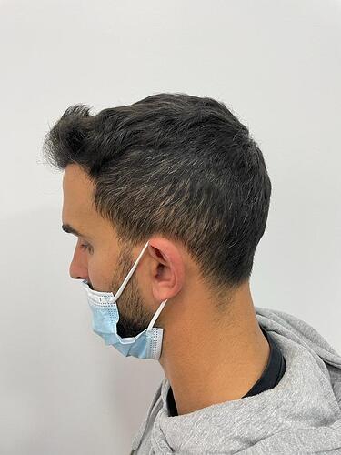 MARTIN MONTOYA - PROFESSIONAL SOCCER PLAYER - PROCEDURE WITH DR BRUNO JACOBOVSKI photo