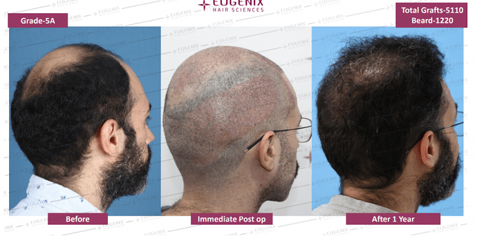 EUGENIX HAIR SCIENCES | FIND YOUR YOUNGER VERSION | DR. ARIKA BANSAL photo