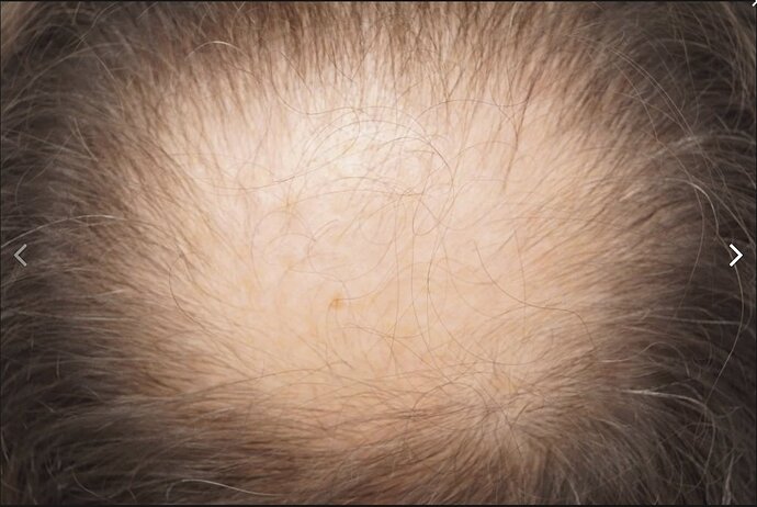Dr B Farjo 2200g FUT (Crown) photo