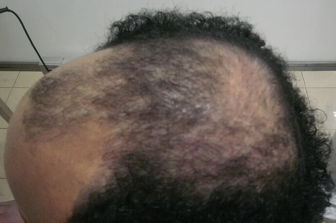 Dr.Bisanga, 1157 Strip Repair, Afro hair, 0 - 7 Months photo