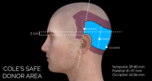 donor-area-selection