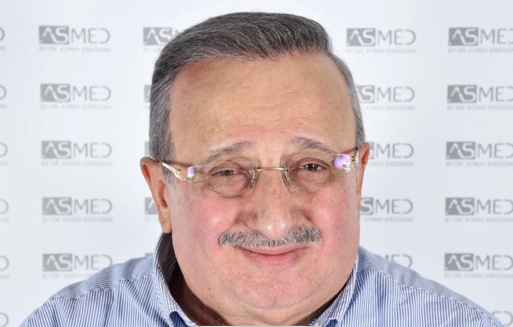 Asmed Clinic - FUE - 4558 Grafts - 12 Month Result. photo